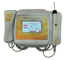Imagem Laser Smile Dual